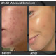 Ексфоліант з саліциловою кислотою Paula's Choice Skin Perfecting 2% BHA Liquid Exfoliant 10 ml